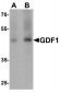 GDF1 Antibody (N-Terminus)